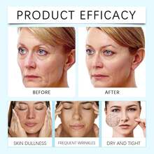 12%壬二酸面部精华液，富含烟酰胺和透明质酸，专为肤色不均和易长痘肌肤设计 - 彩色 - 查看 7