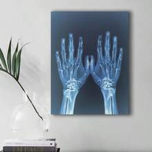 Impresión de pintura de arte de lienzo con rayos X de manos, decoración de pared sin marco, póster moderno de imagen médica, material de tela, regalo creativo para la familia, la oficina y la decoración del hogar, B06212 - A - Ver 1