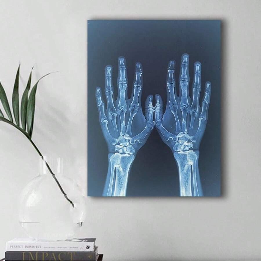 Impresión de pintura de arte de lienzo con rayos X de manos, decoración de pared sin marco, póster moderno de imagen médica, material de tela, regalo creativo para la familia, la oficina y la decoración del hogar, B06212 - A - Ver 1