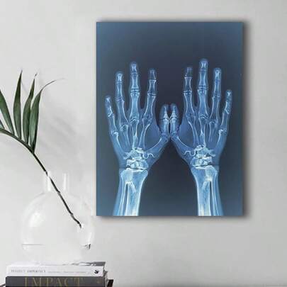 1pc Frameless Painting X-Ray Hands Canvas Wall Arts Posters, Modern Medical Imaging Poster, Cloth Material, Creative Gift For Family, Office And Home Decoration