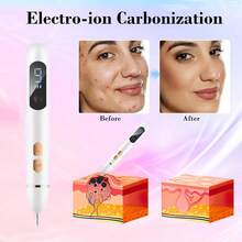 Facial Cleansing Appliances - White - View 7