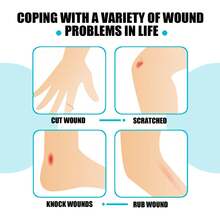 Vendaje líquido impermeable en aerosol para protección de heridas, película invisible, aerosol impermeable y transpirable para el cuidado.-Envío gratis|navidad|regalos navideños|regalitos navideños|skin care coreano|regalos para hombre|regalo para mujer|set de regalo - Celeste - Ver 7