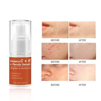 维生素C+E+积雪草酸精华，维生素C提亮肤色淡化色素沉着，维生素E深层保湿，积雪草酸强化肌肤屏障，舒缓肌肤；可提亮肤色，淡化黑斑和色素沉着，为柔软水嫩的肌肤提供长效保湿，还能针对皱纹、黑斑，促进肌肤健康。