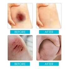 Vendaje líquido impermeable en aerosol para protección de heridas, película invisible, aerosol impermeable y transpirable para el cuidado.-Envío gratis|navidad|regalos navideños|regalitos navideños|skin care coreano|regalos para hombre|regalo para mujer|set de regalo - Celeste - Ver 6