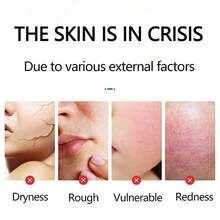 Bearberry Niacinamide Moisturizing Cream, Improves Dullness, Fades Spots, Brightens Complexion, Improves Dryness, Deeply Nourishes And Repairs Skin Barrier, Gentle And Non-Irritating - 玫紅色 - 查看 2