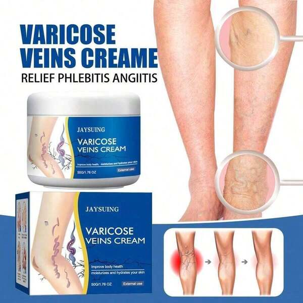 Leg Relief Gentle Herbal Varicose Veins Cream – External Use For Pain, Swelling, And Vein Repair |     Soothing Massage Lotion For Body & Skin Comfort-50g