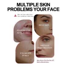 1瓶125毫升谷胱甘肽精华液，精华液，面部护理，保湿补水，温和清洁，提亮肤色。护肤，改善粗糙，淡化色斑，乳液，修复肌肤，紧致肌肤，强化肌肤屏障。 - 彩色 - 查看 6