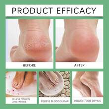Foot Bath Bag Soothing Leg Care Foot Bath Medicine Bag Ginger Safflower Foot Bath Powder Herbal Foot Bath Bag Suitable For Men And Women - Lavender - View 9