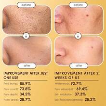 Peel Shot Glow Rice Ampoule Duo Set Day & Night | Exfoliating Facial Peels With Niacinamide Hyaluronic Acid & Rice Extract | Blackhead Remover, Pore Refining - 預設 - 查看 5