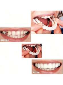 1 Set Of Comfortable & Snug Cosmetic Dentures, Includes Upper & Lower Teeth, Providing A Confident Smile Experience. The Veneers Dentures Bring A Radiant Smile. - Multicolor - View 2