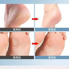 Foot Files & Pedicure Knife - Blue - View 6