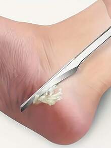 1把修脚刀，足部磨平工具，去除老茧和死皮的神奇工具，专业修脚刀，家用磨脚器 - 彩色 - 查看 1