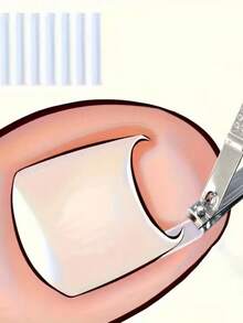 Bộ 200 miếng đệm chỉnh hình móng chân mọc ngược không gây đau, phù hợp với nhiều nhu cầu chăm sóc chân, làm móng chân. - Nhiều màu - Xem 4