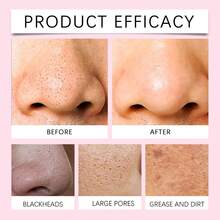 Hoygi Niacinamide Deep Cleansing Milk Cleanses Pores Gently, Removes Acne, Cleanses Face With Refreshing Care, Moisturizes And Nourishes - Hồng 1 hộp - Xem 7