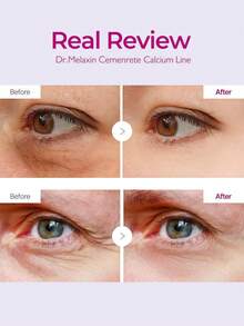 Dr.Melaxin Cemenrete 多效保湿霜 | 抗衰老、紧致、抚平皱纹 | 韩国化妆品 - 彩色 - 查看 3