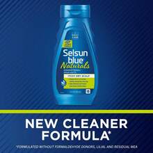 Blue Itchy Dry Scalp, Naturals, 11 Ounce - 1 - Ver 11