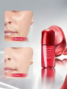 Shiseido Concentrado potenciador Ultimune 10ml - Suero antienvejecimiento, reparación de la barrera cutánea, cuidado reafirmante y antiarrugas, prevención del envejecimiento prematuro, reafirmante facial, potenciador de la resistencia de la piel, tamaño de viaje-10ml/0.34oz