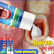 New Tooth Decay Prevention Toothpaste Effective Treatment Decayed Tooth Whitening Toothpaste Removal Yellow Toothpaste TeethCare - 1pcs - View 1