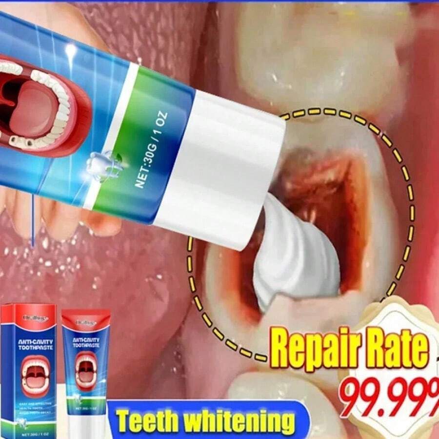 New Tooth Decay Prevention Toothpaste Effective Treatment Decayed Tooth Whitening Toothpaste Removal Yellow Toothpaste TeethCare - 1 cái - Xem 1