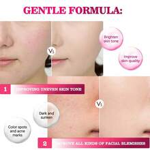 ACM DÉPIWHITE ADVANCED Depiwhite Advanced Anti-Taches & Anti-Brown Spot Cream 40 ML - 彩色 - 查看 5