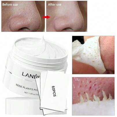 黑头去除面膜 - 鼻部及面部撕拉式面膜，黑头去除套装 1.05盎司