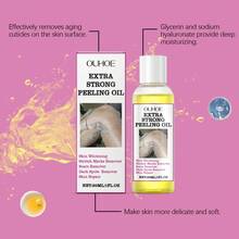 OUHOE 30ml Exfoliating Yellow Skin Oil, Exfoliating, Brightening, Moisturizing, Remove Dark Dead Skin, Leg/Arm Lightening M-Elanin Whitening, Firming, Nourishing - Amarillo - Ver 7