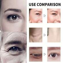 Qingling Face Cream, Quinglin Crema Para Arrugas, Qingling Wrinkle Removal Cream, Polypeptide Tightening And Anti-Wrinkle Cream, Facial Neck Eye Cream Anti-Aging For Men & Women - 彩色 - 查看 2
