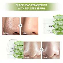 黑头去除面膜 - 鼻部及面部撕拉式面膜，黑头去除套装 1.05盎司