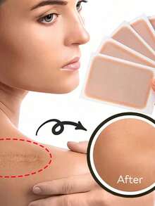 Silicone Scar Sheets - Gentle, Washable, Reusable, Suitable For Surgical Scars, C-Section Scars And Keloid Scars - Soft, Breathable, Waterproof Silicone Scar Sheets, Effective Scar Management