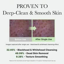 arencia Rice Mochi Face Cleanser, Face Mask, Foaming Cleanser, Gentle Scrub All In One ,Deep Cleansing, Moisturizing, Pore Minimizing, Removing Blackhead,With Rice Water & Green Tea, Mugwort - 120g - Xem 7