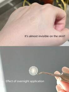 Olive Young Care Plus 162片装祛痘贴，适用于面部和身体 - 快速起效，纯素且无动物实验，韩国护肤品，韩国美妆礼品，韩国化妆品 - 102 sheets - 查看 3