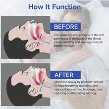 1 pieza | Clip nasal anti ronquidos, alivio de ronquidos, solución para dormir, clip nasal anti ronquidos unisex - silicona y magnético, para una respiración tranquila, ajuste cómodo | Reduce los ronquidos nocturnos, mejora el sueño... Adecuado para viajes y siestas - Multicolor - Ver 8