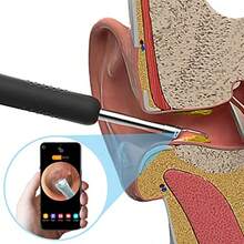 R1 Ear Wax Removal Tool Camera Endoscope 1080P HD Otoscope Wireless Ear Cleaner With6 Led Lights Compatible With IPhone IPad Smart PhonesandTablets For AdultsandPets White - 如圖 - 查看 2