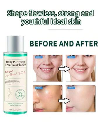 Miracle Blackhead Clearing Toner - การทำให้บริสุทธิ์ทุกวัน, มี Salicylic Acid, การทำความสะอาดรูขุมขนอย่างล้ำลึก, ควบคุมความมัน, เหมาะสำหรับผิวมัน/ผิวผสม - สกินแคร์เกาหลี
