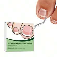 （50+2 包嵌甲矫正治疗套装，50 片嵌甲矫正贴片，嵌甲修脚工具，嵌甲矫正贴片，含 2 个嵌甲提拉器和锉刀）