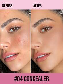 MISSLYN Concealer, Concealing Liquid, Evens Skin Tone, Containing Light Reflecting Pigments And Moisturizing Complex, Multi-Purpose Concealer, Lightweight Texture, High Coverage, Long-Lasting Hydration, Brightens Complexion, Creamy Texture, Waterproof, Long-Lasting Makeup - #4 - View 3