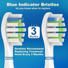 Replacement Heads Compatible With Philips Sonicare Toothbrush 4100 5100 6100 1100 2100 3100, 8 Pack{Inchsize_nameinch:Inch1Count(Packof8)Inch,Inchcolor_nameinch:InchWhite+Blackinch} - White+Black - View 8