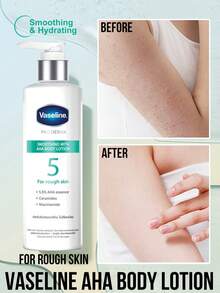 Vaseline 凡士林 AHA 柔滑润肤乳，适合粗糙肌肤，令肌肤光滑细腻，改善粗糙，修复干燥，蕴含 5.5% AHA 精华，富含神经酰胺和烟酰胺，适合所有肤质，经皮肤科医生测试，3 天显著改善肌肤，用户满意度高。 - 5 AHA - 查看 6