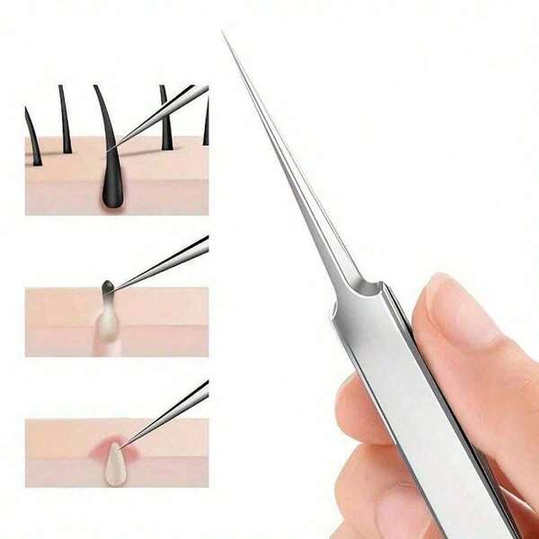 1 pezzo Pinzette di precisione, utilizzate per rimuovere punti neri e brufoli, realizzate in acciaio inossidabile, adatte per tutti i tipi di pelle
