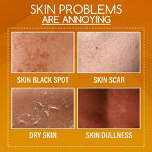 OUHOE Orange Peeling Lotion Body Lotion Gentle Exfoliation Gel Tearable Fading Dark Spots Leg Arm Nourishing Moisturizing Firming Skin Care Liquid - trái cam - Xem 3