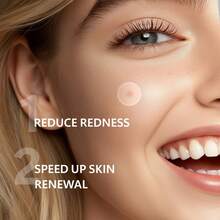 24pcs/12pcs Acne Pimple Patches, Hydrocolloid Material, Gentle & Non-Irritating, Containing Tea Tree Oil, Covers Body Blemishes, Alcohol-Free, Scar Covering