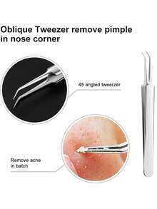 Four-Piece Slanted-Tip Stainless Steel Blackhead Remover Set, Pimple Extractor, Acne Remover, Blackhead And Whitehead Remover, Medical-Grade Acne Treatment Tool, Face, Nose And T-Zone Blemish Removal Kit, Suitable For Blackheads, Pimples, Whiteheads, Acne And Blemishes.