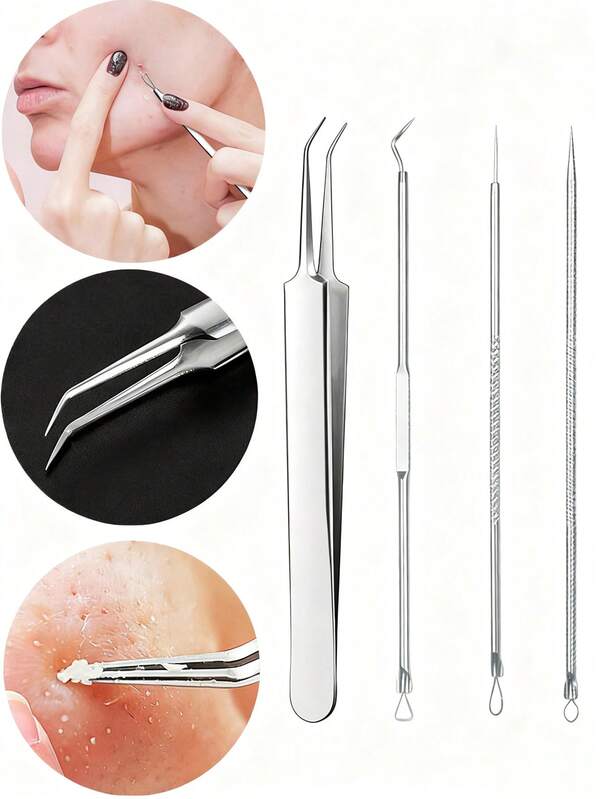 Set di 4 pezzi in acciaio inossidabile con punte inclinate, rimozione di punti neri, estrattore di brufoli, rimozione di acne, rimozione di punti neri e punti bianchi, strumento di trattamento dell'acne di grado medico, kit per la rimozione di imperfezioni su viso, naso e zona T, adatto per punti neri, brufoli, punti bianchi, acne e imperfezioni.