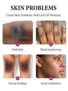 3pcs Yellow Peeling Oil With Salicylic Acid For Brightening, Whitening And Exfoliation, Even Skin Tone, Oil For Dark Skin 110ml, Suitable For All Skin Types, Unisex, Suitable For Dating, Traveling, Make Your Skin Glow,Christmas Gifts, Holiday Travel Essentials - Màu vàng - Xem 11