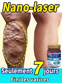 Varicose Vein  Effective Varicose Vein Relief  Relieves Vasculitis Spider Vein Treatment Foot Care Tool - 1 CÁI - Xem 1