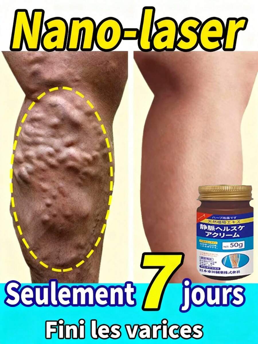 Varicose Vein Effective Varicose Vein Relief Relieves Vasculitis Spider Vein Treatment Foot Care Tool - 1 CÁI - Xem 1