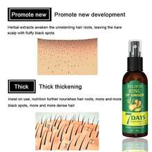 Ginger Hair Spray (50ml Box) Strengthens Hair, Massages Scalp And Repairs Hair-Free Shipping-Quick Ship Items-Christmas Gifts|Stocking Stuffers|Stocking Stuffers For Women|Gifts For Women|Travel Essential|Small Gifts - 綠色 - 查看 8