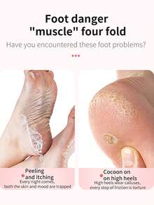 Rechargeable Electric Foot Grinder, Electric Foot Grinder, Four Replaceable Grinding Heads, Portable And Easy To Use, USB Charging, Suitable For Dry And Cracked Soles, Ideal Gift For Parents - Multicolor - View 7