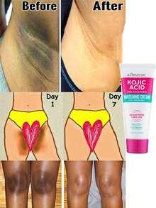 5片装腋下美白霜，有效去除腋窝、膝盖和肘部暗沉。蕴含植物精华和胶原蛋白，美白保湿，令肌肤白皙亮泽。母亲节好礼