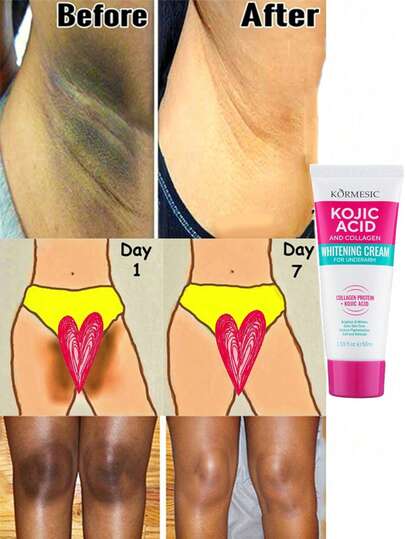 5片装腋下美白霜，有效去除腋窝、膝盖和肘部暗沉。蕴含植物精华和胶原蛋白，美白保湿，令肌肤白皙亮泽。母亲节好礼